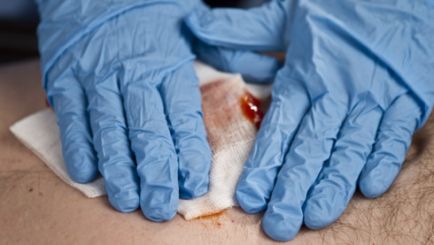 How to deal with a serious bleeding injury